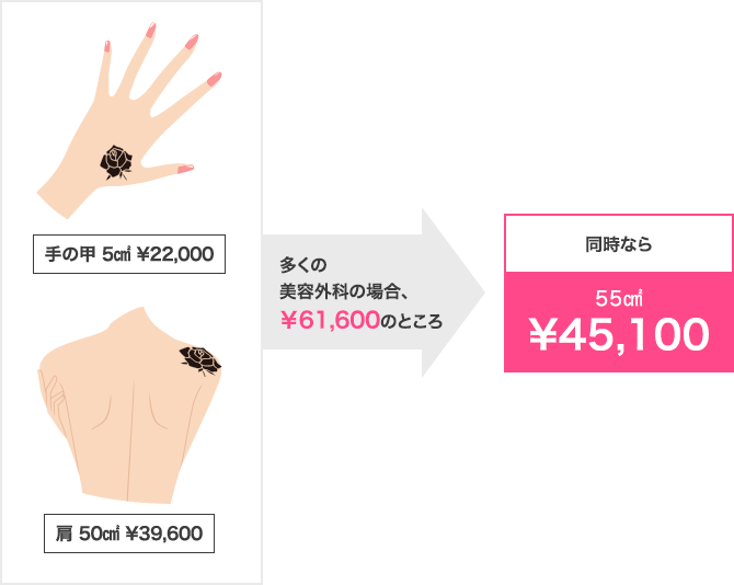 手の甲5㎠&yen;22,000と肩50㎠&yen;39,600→多くの美容外科の場合&yen;61,600のところ、同時なら55㎠&yen;45,100