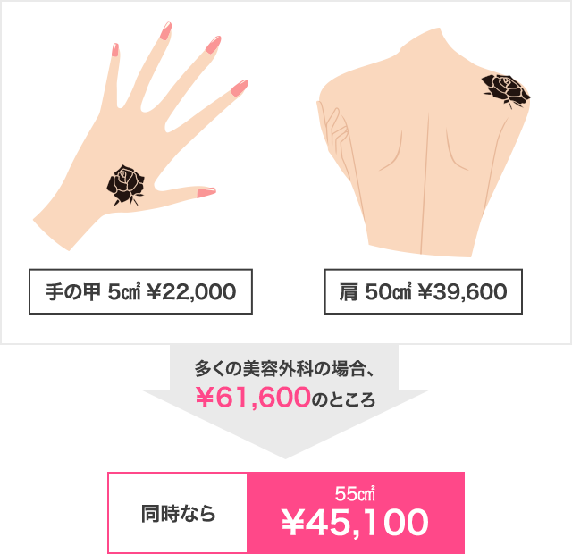 手の甲5㎠&yen;22,000と肩50㎠&yen;39,600→多くの美容外科の場合&yen;61,600のところ、同時なら55㎠&yen;45,100