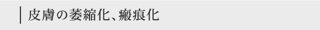 皮膚の萎縮化、瘢痕化